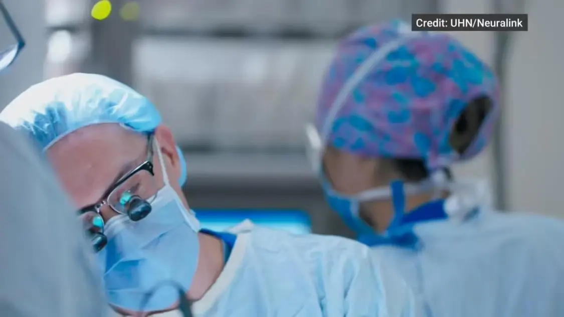 馬斯克Neuralink進軍加拿大,成功完成其美國之外首例腦機接口植入手術